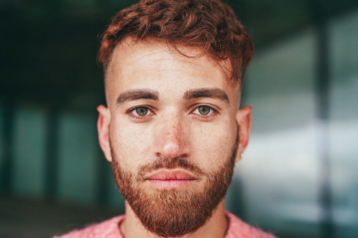 Blépharoplastie