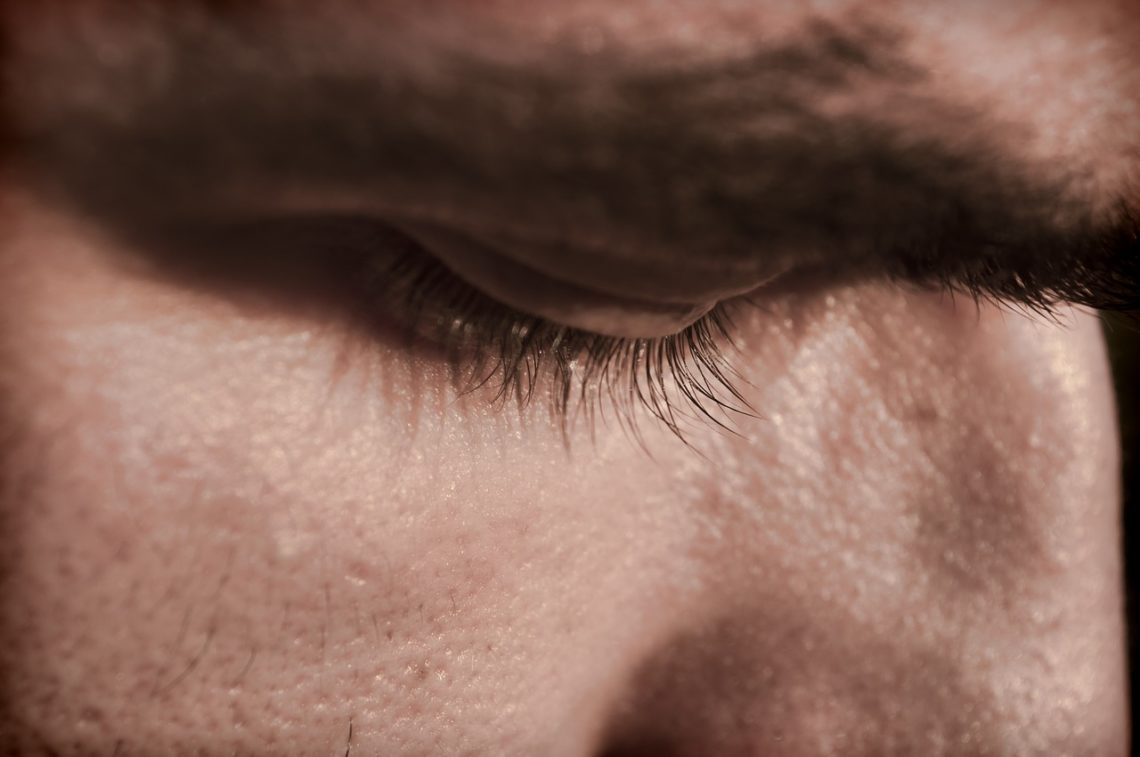Peau sèche chez l'homme