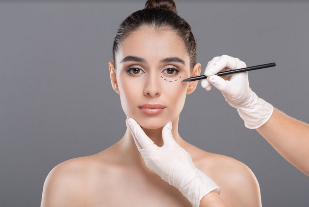 blépharoplastie