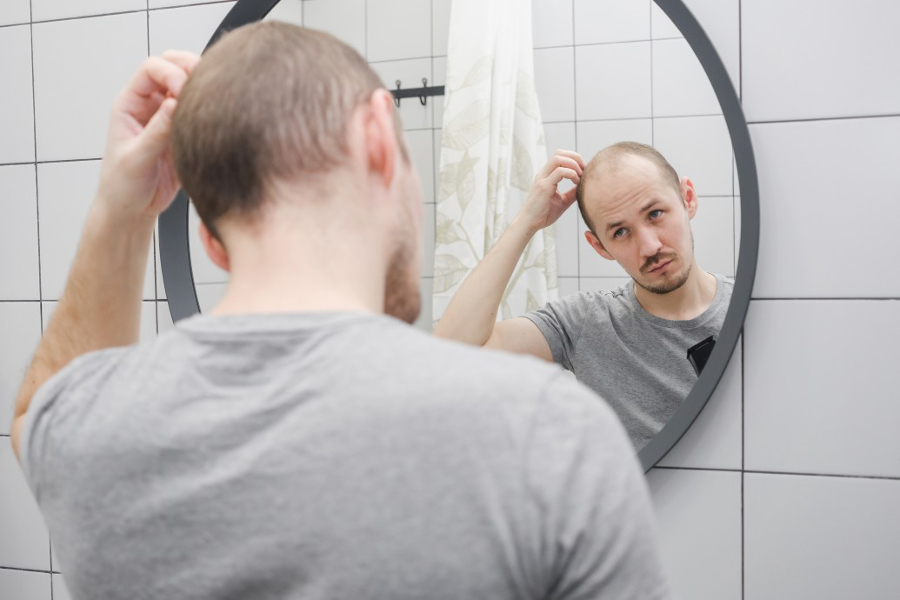 perte cheveux